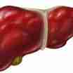 素食者更易得脂肪肝 脂肪肝饮食注意什么